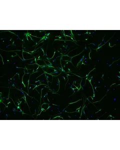 Human Neurons HN - immunostained for beta tubulin III (green), 200x
