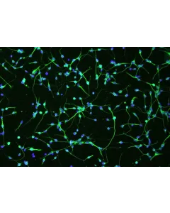 Human Oligodendrocyte Precursor Cells (HOPC) - Immunostaining for A2B5, 100x.

