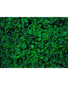 Human Ovarian Microvascular Endothelial Cells (HOMEC) - Immunostaining for vWF, 100x.
