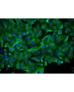Human Ovarian Surface Epithelial Cells (HOSEpiC) - Immunostaining for CK-18, 400x.
