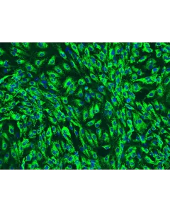 Human Pancreatic Microvascular Endothelial Cells (HPaMEC)-Immunostaining for vWF (Sigma-Aldrich Cat. #F3520), 200x.
