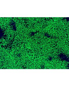 hPSC-Derived Neural Crest Cells (hPSC-NCC) - Immunostaining for SOX10, 100x