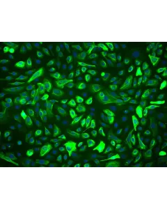 Human Prostate Epithelial Cells (HPrEpiC) - Immunostaining for CK-18, 200x.
