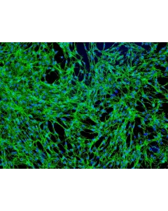Human Prostate Fibroblasts (HPrF) - Immunostaining for Fibronectin, 100x.