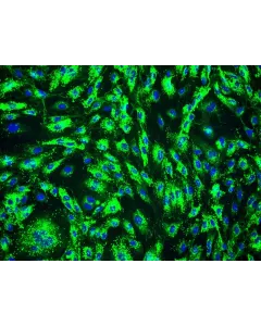 Human Prostate Microvascular Endothelial Cells (HPrMEC) - Immunostaining for vWF, 200x.

