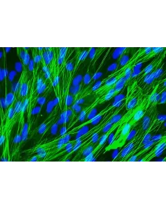 Human Pulmonary Artery Smooth Muscle Cells [HPASMC] - Immunostaining for α-SMA, 400x.
