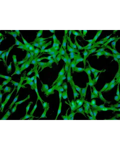 Human Pulmonary Mesenchymal Stem Cells (HPMSC) - Immunostaining for CD73, 200x.
