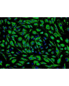 Human Pulmonary Microvascular Endothelial Cells (HPMEC) - Immunostaining for vWF, 200x.
