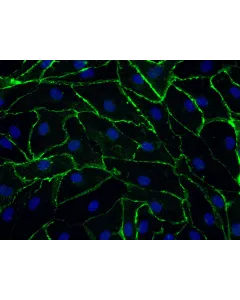 Human Rectal Microvascular Endothelial Cells (HRecMEC), Immunostaining for CD-31, 400x.
