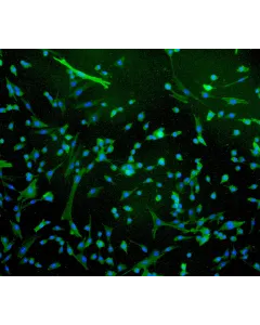 Human Rectal Smooth Muscle Cells (HRSMC) - Immunostaining for α-SMA, 100x.
