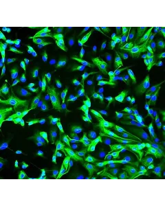 Human Renal Coritcal Epithelial Cells (HRCEpiC) - Immunostaining for CK-18, 200x.
