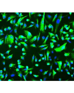 Human Renal Epithelial Cells (HREpiC) - Immunostaining for CK-18, 200x.
