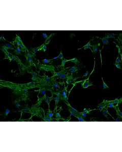 Human Renal Mesangial Cells (HRMC) - Immunostaining for Fibronectin, 200x.