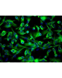 Human Renal Proximal Tubular Epithelial Cells (HRPTEpiC) - Immunostaining for CK-18, 200x.
