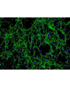 Human Seminal Vesicle Fibroblasts (HSVF) - Immunostaining for Fibronectin, 200x.
