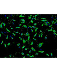 Human Seminal Vesicle Microvascular Endothelial Cells (HSVMEC) - Immunostaining for vWF, 100x.
