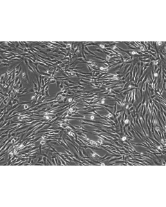 Human Seminal Vesicle Smooth Muscle Cells (HSVSMC) - Phase Contrast, 100X
