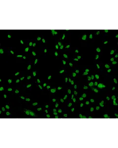 Human Sertoli Cells (HSerC)-Immunostaining for SOX-9, 200x.
