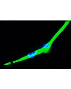 Human Skeletal Muscle Cells (HSkMC) - Immunostaining for Myosin, 400x.
