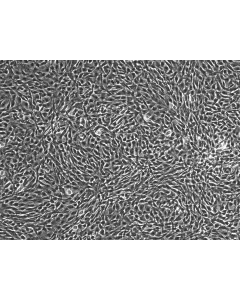 HUMAN SKELETAL MUSCLE MYOBLASTS (HSkMM)- phase contrast 100X
