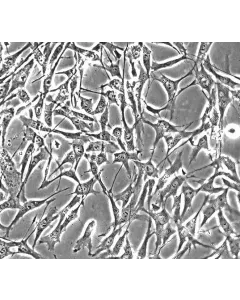 Human Skeletal Muscle Satellite Cells (HSkMSC) - Phase contrast, 200x.
