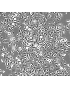Human Small Airway Epithelial Cells (HSAEpiC) - Phase contrast 100x