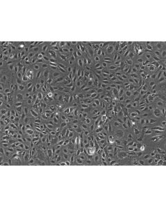 Human Testicular Endothelial Cells (HTEC)-Phase contrast, 100x.
