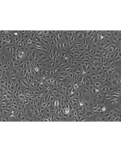 Human Testicular Endothelial Cells (HTEC)-Phase contrast, 100x.
