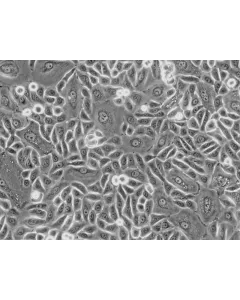 Human Tonsil Epithelial Cells (HTEpiC) - Phase contrast, 200x.
