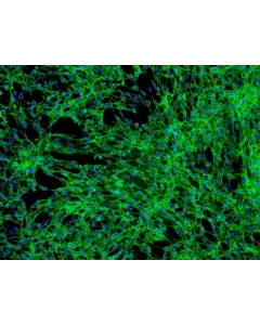 Human Tonsil Fibroblasts (HTF) - Immunostaining for Fibronectin, 100x.
