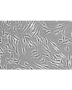 Human Trabecular Meshwork Cells (HTMC) - Phase contrast, 200x.
