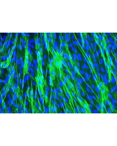 Human Tracheal Smooth Muscle Cells (HTSMC) - Immunostaining for .
