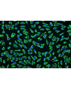 Human Umbilical Artery Endothelial Cells (HUAEC) - Immunostaining for vWF, 200x.
