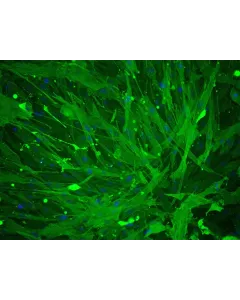 Human Umbillical Artery Smooth Muscle Cells (HUASMC) - Immunostaining for α-SMA, 200x.
