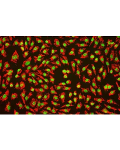 Human_Umbilical_Vein_Endothelial_Cells (HUVEC) – Immunofluorescence for vWF (Sigma-Aldrich Cat.#F3520), 200x.
