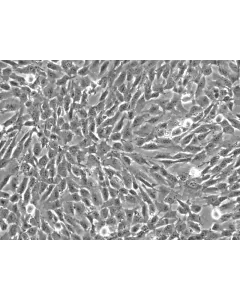Human Vertebral Mesenchymal Stem Cells (HVMSC) - Phase contrast, 200x.
