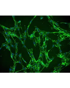 Human Villous Mesenchymal Fibroblasts (HVMF) - Immunostaining for Fibronectin, 200x.
