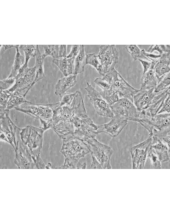 Human Villous Trophoblasts (HVT) - Phase Contrast, 400x
