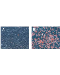 Hepatocytes were either left untreated (A) or treated with 200 μM oleic acid (B). The treated cells exhibited a significant accumulation of lipid droplets, as evidenced by the abundant presence of red dots observed through Oil Red O staining(B).