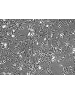 Mouse Astrocytes-cerebellar (MA-c) - Phase contrast, 100x.
