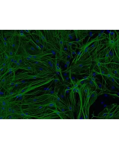 Mouse Astrocytes-hippocampal (MA-h) - Immunostaining for GFAP, 200x.
