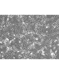 Mouse Astrocytes-spinal cord (MA-sc) - Phase contrast, 100x.
