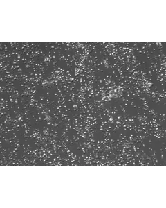 Mouse Bone Marrow Mononuclear Cells (MBMMC) – Relief Contrast, 200x
