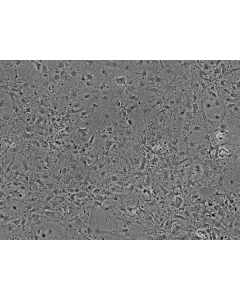 Mouse Cardiac Myocytes (MCF) - Phase contrast, 100x.