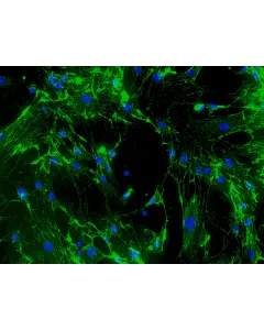 Mouse Cardiac Fibroblasts (MCF) - Immunostaining for Fibronectin, 200x.