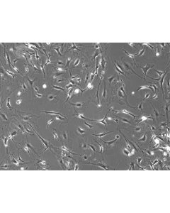Mouse Dermal Fibroblasts (MDF)- Phase Contrast, 100x