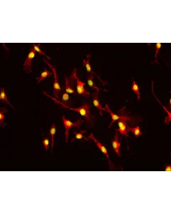 Mouse Hepatic Macrophages (MHMa)-Immunostaining for F4/80, 400x
