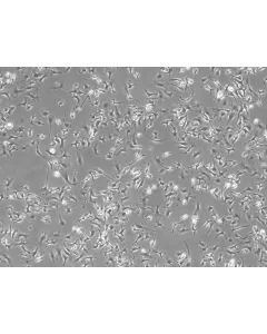 Mouse Hepatic Macrophages (MHMa)-Phase Contrast, 100x.
