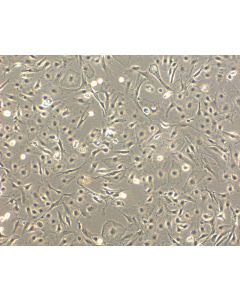 Mouse Hepatic Mesothelial Cells (MHMeC) - Phase Contrast, 100x