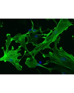 Mouse Hepatic Stellate Cells (MHSteC) – Immunostaining for α-sma, 200x

